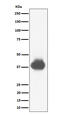 Fc Fragment Of IgG Receptor IIa antibody, M01450-2, Boster Biological Technology, Western Blot image 