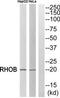 Ras Homolog Family Member B antibody, TA313472, Origene, Western Blot image 