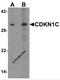 Cyclin Dependent Kinase Inhibitor 1C antibody, 7015, ProSci Inc, Western Blot image 