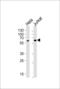 Heparanase 2 (Inactive) antibody, LS-C165007, Lifespan Biosciences, Western Blot image 