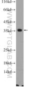 Cyclin N-Terminal Domain Containing 1 antibody, 24854-1-AP, Proteintech Group, Western Blot image 