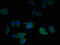 Secretory Leukocyte Peptidase Inhibitor antibody, LS-C211923, Lifespan Biosciences, Immunofluorescence image 