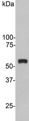 Vimentin antibody, LS-C204598, Lifespan Biosciences, Western Blot image 