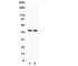 Zinc transporter 4 antibody, R31313, NSJ Bioreagents, Western Blot image 