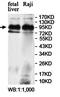 Zinc Finger Protein 546 antibody, orb78220, Biorbyt, Western Blot image 