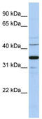 Wnt Family Member 5A antibody, TA329908, Origene, Western Blot image 