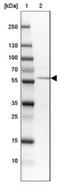 Amidophosphoribosyltransferase antibody, NBP1-89744, Novus Biologicals, Western Blot image 