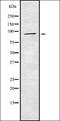 Suppression Of Tumorigenicity 14 antibody, orb378325, Biorbyt, Western Blot image 