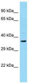 Homeobox protein EMX2 antibody, TA329368, Origene, Western Blot image 