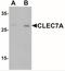 C-Type Lectin Domain Containing 7A antibody, NBP2-41170, Novus Biologicals, Western Blot image 