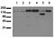 Erb-B2 Receptor Tyrosine Kinase 4 antibody, AM00056PU-N, Origene, Western Blot image 