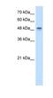Dihydroorotate Dehydrogenase (Quinone) antibody, NBP1-59584, Novus Biologicals, Western Blot image 