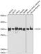 Holocytochrome C Synthase antibody, GTX33236, GeneTex, Western Blot image 