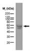CD74 antibody, NB100-65541, Novus Biologicals, Western Blot image 
