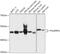 Pancreatic Lipase Related Protein 1 antibody, 16-969, ProSci, Western Blot image 