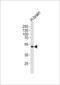 Potassium Voltage-Gated Channel Subfamily J Member 12 antibody, LS-C159976, Lifespan Biosciences, Western Blot image 
