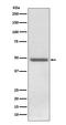 Perilipin 2 antibody, M04328-1, Boster Biological Technology, Western Blot image 