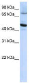 Cytochrome P450 Family 46 Subfamily A Member 1 antibody, TA332027, Origene, Western Blot image 