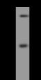LysM Domain Containing 3 antibody, 205675-T32, Sino Biological, Western Blot image 