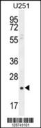 Siah E3 Ubiquitin Protein Ligase Family Member 3 antibody, 55-506, ProSci, Western Blot image 