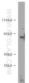 SAH antibody, 10168-2-AP, Proteintech Group, Western Blot image 