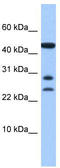Chromosome 20 Open Reading Frame 141 antibody, TA340246, Origene, Western Blot image 