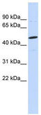 CSPG5 antibody, TA341846, Origene, Western Blot image 