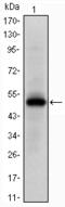 EPH Receptor A10 antibody, M09787, Boster Biological Technology, Western Blot image 