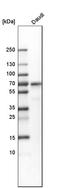 Lymphoid Restricted Membrane Protein antibody, HPA002967, Atlas Antibodies, Western Blot image 