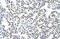 Heterogeneous nuclear ribonucleoprotein A3 antibody, ARP41195_T100, Aviva Systems Biology, Immunohistochemistry paraffin image 