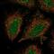 Coiled-Coil Domain Containing 122 antibody, NBP2-54949, Novus Biologicals, Immunofluorescence image 