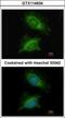 Phosphoglucomutase 3 antibody, GTX114634, GeneTex, Immunofluorescence image 