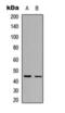 Interleukin 13 Receptor Subunit Alpha 2 antibody, orb393080, Biorbyt, Western Blot image 