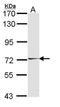 Hormonally Up-Regulated Neu-Associated Kinase antibody, GTX108203, GeneTex, Western Blot image 