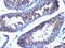 PRL-R antibody, GTX34985, GeneTex, Immunohistochemistry paraffin image 