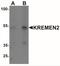 Kremen protein 2 antibody, NBP2-22339, Novus Biologicals, Western Blot image 