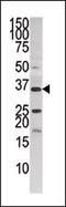 Pantothenate Kinase 3 antibody, 62-696, ProSci, Western Blot image 
