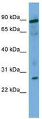 Ubiquitin Conjugating Enzyme E2 F (Putative) antibody, TA340245, Origene, Western Blot image 