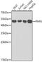 PHD finger protein 6 antibody, GTX33408, GeneTex, Western Blot image 