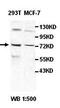 Heterogeneous nuclear ribonucleoprotein M antibody, orb77777, Biorbyt, Western Blot image 