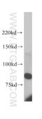 Phospholipase C Delta 1 antibody, 14228-1-AP, Proteintech Group, Western Blot image 