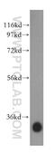 3-Hydroxybutyrate Dehydrogenase 1 antibody, 15417-1-AP, Proteintech Group, Western Blot image 