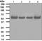 RAD23 Homolog A, Nucleotide Excision Repair Protein antibody, TA307254, Origene, Western Blot image 