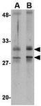 Methyltransferase Like 7A antibody, GTX85369, GeneTex, Western Blot image 