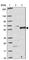 RIO Kinase 3 antibody, HPA001620, Atlas Antibodies, Western Blot image 