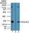 POU Class 3 Homeobox 2 antibody, NBP2-24658, Novus Biologicals, Western Blot image 