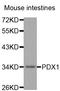 Pancreas/duodenum homeobox protein 1 antibody, STJ24953, St John