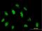 Centromere Protein B antibody, H00001059-B01P, Novus Biologicals, Immunocytochemistry image 