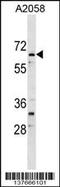 AT-Rich Interaction Domain 5A antibody, 59-331, ProSci, Western Blot image 