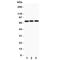 Amyloid Beta Precursor Like Protein 1 antibody, R31208, NSJ Bioreagents, Western Blot image 